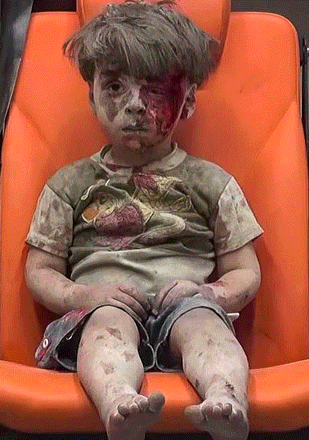 Widely-disseminated image of 5-year-old Omran Daqneesh